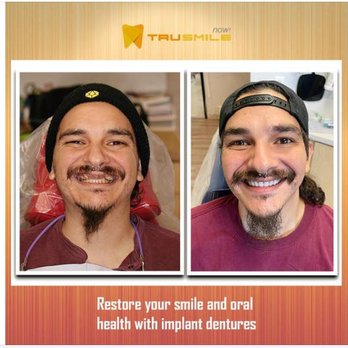 TruSmile Now - General Dentistry Near Me - Peoria, Arizona TruSmile Now - General Dentistry Near Me - Peoria, Arizona