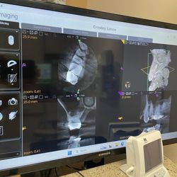 Modern Endodontics - Tooth pix