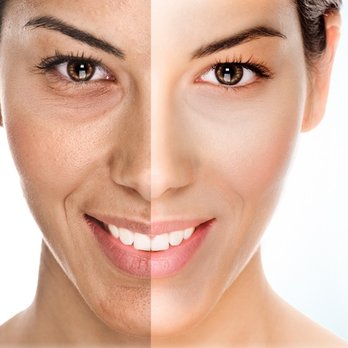 Generations Wellness Center - The Oxygeno Facial helps minimize fine lines and dark spots and gives your skin new life! - Medical Spas Near Me - Cary, North Carolina