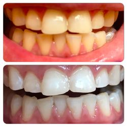 The One And Only Dental Care - 1 hour later...