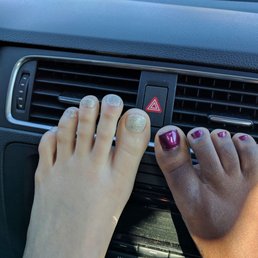 My friends toes look terrible My friends toes look terrible