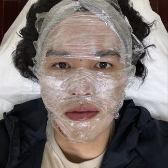 OC Aesthetic Med Spa - Waiting for numbing cream to take effect - Medical Spas Near Me - Westminster, California