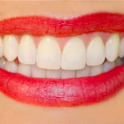 Oceanview Dental Care - my perfect smile
