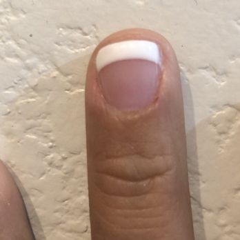 Century Nails - Ouch that was pain-full and it will be for the next four or five days. - Nail Salons Near Me - Phoenix, Arizona