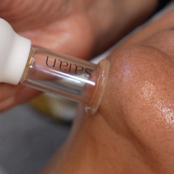 Allikai Spa - Facial Cupping - Sculpt and Depuff