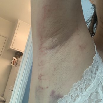 Advanced Aesthetics - This was day one. - Skin Care Near Me - Beverly Hills, California
