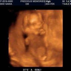 Precious Memories 3D/4D/HD Ultrasound Imaging