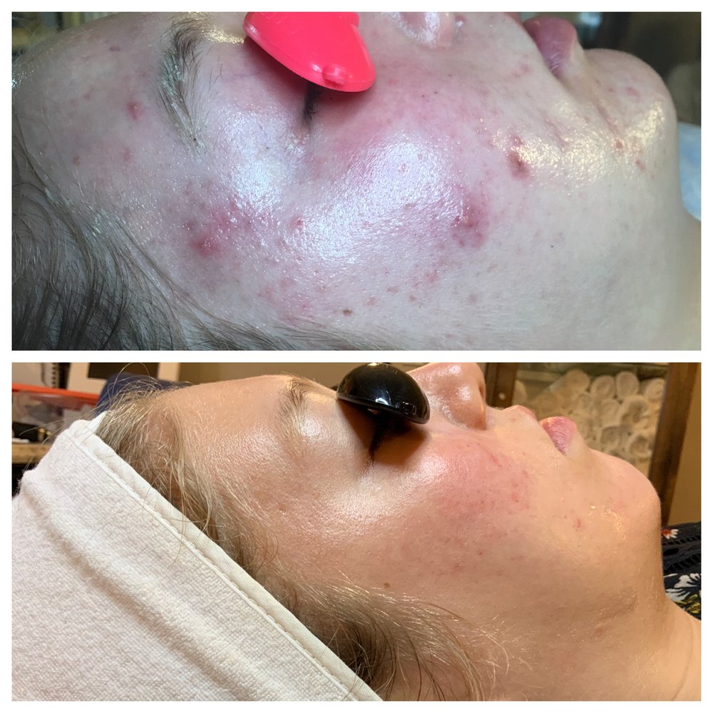 Dermal 911 Acne And Skin Care Logo