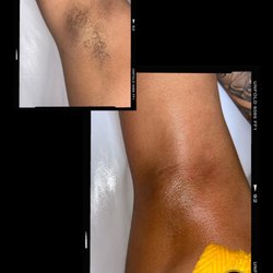 Sunflower Body Waxing