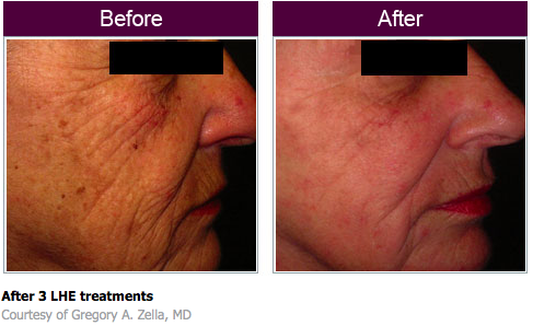 You Rejuvenated by null