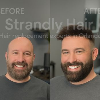 Strandly Hair - Hair Loss Centers Near Me - Orlando, Florida Strandly Hair - Hair Loss Centers Near Me - Orlando, Florida