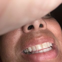 Panther Creek Dental of Frisco