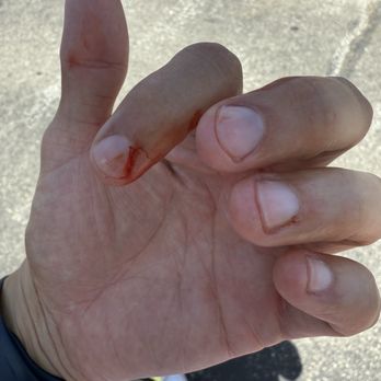 Qt Nails - The lady pulled too much of my skin (sorry if it's too graphic) - Nail Salons Near Me - Long Beach, California