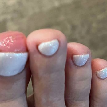 Bliss Nail Lounge - Severely infected toe from cuticle device- - Nail Salons Near Me - Colorado Springs, Colorado