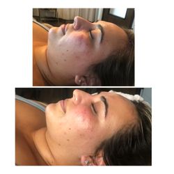 BeeKini & Beauty - Custom Pumpkin peel
Sealed with Retinol
$100