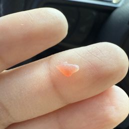 This was inside my drink!! This was inside my drink!!