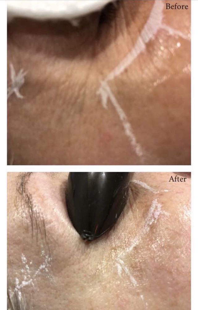 The Skin Lab, Overland Park Roadtrippers