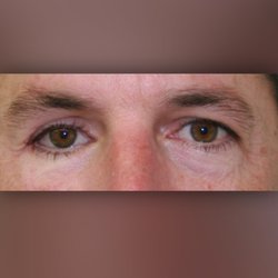 Prosthetic Artists - We create our eyes to look real from inches away, not just from conversational distance. Come see the difference!