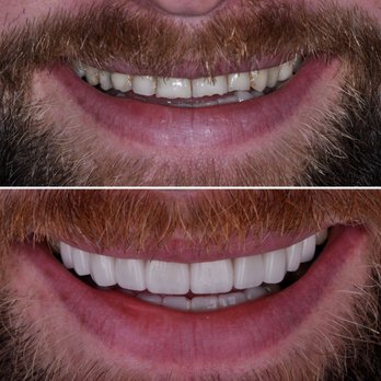 West Seattle Smile - General Dentistry Near Me - Seattle, Washington West Seattle Smile - General Dentistry Near Me - Seattle, Washington