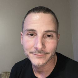 Hair Restoration Specialists of Atlanta - Hair is looking so much better