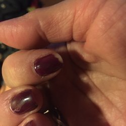 Chip on index finger after only 3 days of a shellac manicure