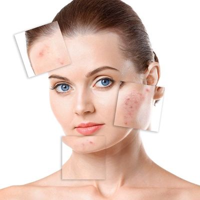 Medical Dermatology