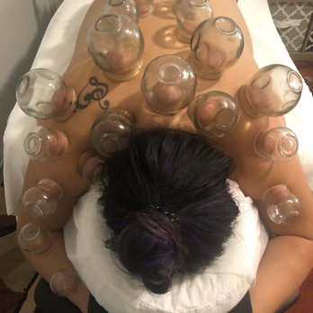 Acupuncture Thousand Branches - Fire cupping - Pain Management Near Me - Newport Beach, California Acupuncture Thousand Branches - Fire cupping - Pain Management Near Me - Newport Beach, California