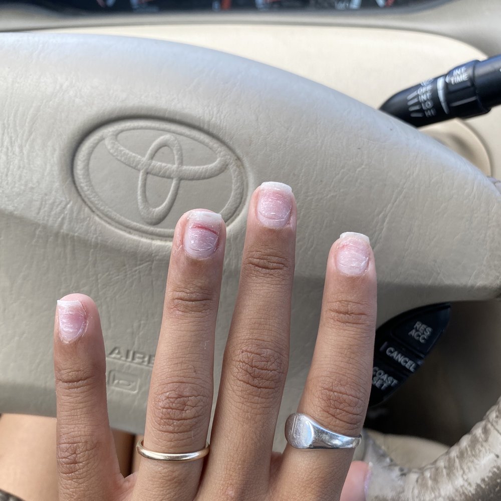 Top Line Nails - Ripped nails from removing acrylic set - Nail Salons Near Me - Tampa, Florida Top Line Nails - Ripped nails from removing acrylic set - Nail Salons Near Me - Tampa, Florida