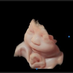 3D Ultrasound Face Pictures!