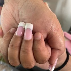 Stop 4 Nails - The 2 fingers that fell off after only getting this done a few days ago.