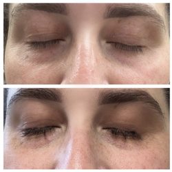 HK Dermatology - Clinically-proven to boost the appearance of thicker lashes and brows. Obagi Nu-Cil sold in office.