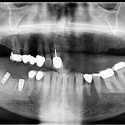 Coast Dental - After Choi
