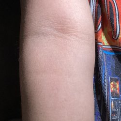 Preston Dermatology + Skin Surgery - May 2023
