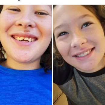 C Squared Dentistry - Before and after - General Dentistry Near Me - Valencia, California C Squared Dentistry - Before and after - General Dentistry Near Me - Valencia, California