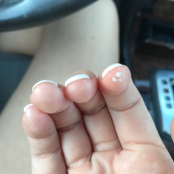 Anna Nails & Spa - Gel polish left on skin. - Nail Salons Near Me - Phoenix, Arizona Anna Nails & Spa - Gel polish left on skin. - Nail Salons Near Me - Phoenix, Arizona