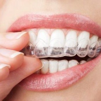 Princeton Prosthodontics - Cosmetic Dentists Near Me - Princeton, New Jersey Princeton Prosthodontics - Cosmetic Dentists Near Me - Princeton, New Jersey