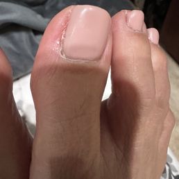 This is the day after pedi This is the day after pedi