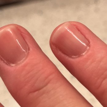 US Nails - Cuticles on day two. - Nail Salons Near Me - San Diego, California US Nails - Cuticles on day two. - Nail Salons Near Me - San Diego, California