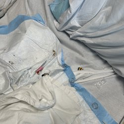 Baptist Memorial Hospital - North Mississippi - Dirty and filthy bed.