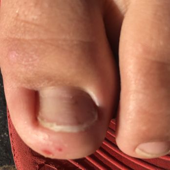 Ava Nails & Spa - Injury was already there. Dirty and edgy. - Nail Salons Near Me - Antelope, California Ava Nails & Spa - Injury was already there. Dirty and edgy. - Nail Salons Near Me - Antelope, California