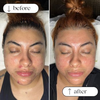 The Ageless Esty - Skin Care Near Me The Ageless Esty - Skin Care Near Me