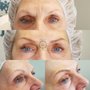Photo of Bellissimo Brows