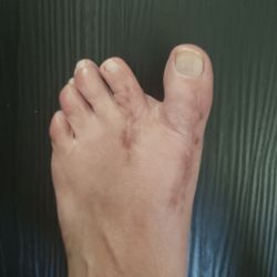 Franklin Foot Care of Rhode Island