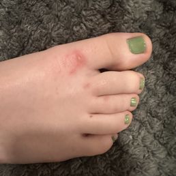 Pedicure with infection