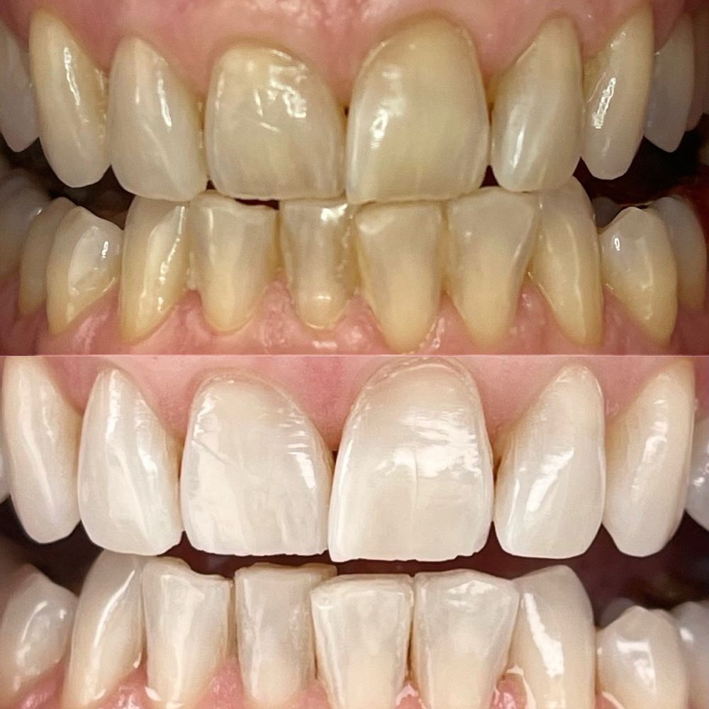 Brighter Smiles Logo