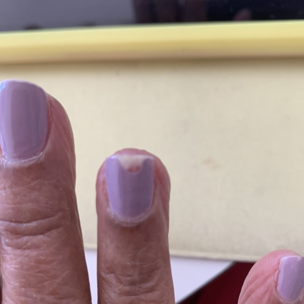 Coco Nails & Spa - Chipped nail polish after one through two days. - Nail Salons Near Me - Gaithersburg, Maryland