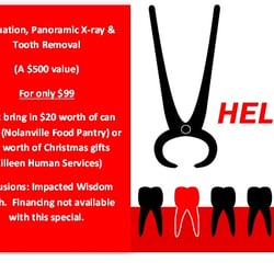 Barbra Griffin - $99 Tooth Removals