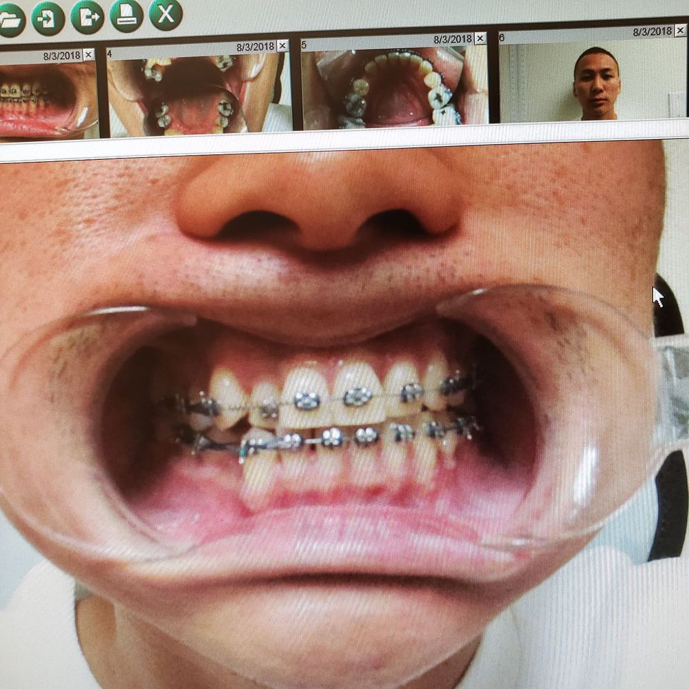 Fagin Orthodontics - Orthodontists Near Me - Fresno, California Fagin Orthodontics - Orthodontists Near Me - Fresno, California