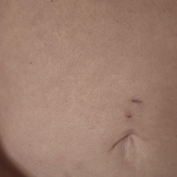 Sono Bello - Cosmetic Surgeons Near Me - Woburn, Massachusetts Sono Bello - Cosmetic Surgeons Near Me - Woburn, Massachusetts