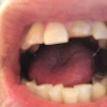 Apple Dental Center - Proof - General Dentistry Near Me - Corpus Christi, Texas